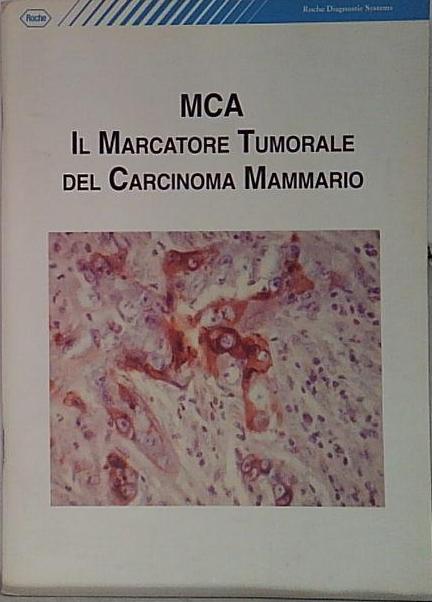 del carcinoma mammario