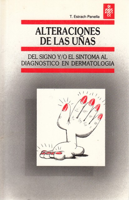 Alteraciones de las uñas. Del signo y/o el síntoma al …