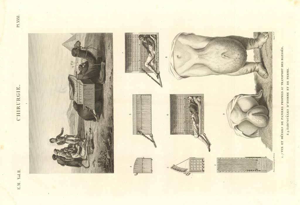 Chirurgie - Vue et détails de paniers propreas au transport …