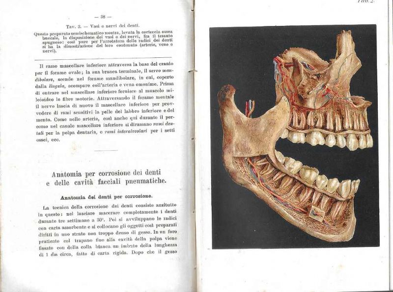 Atlante e compendio di odontojatria e delle malattie della bocca.