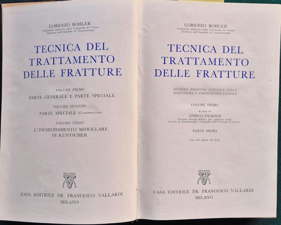 Tecnica del trattamento delle fratture