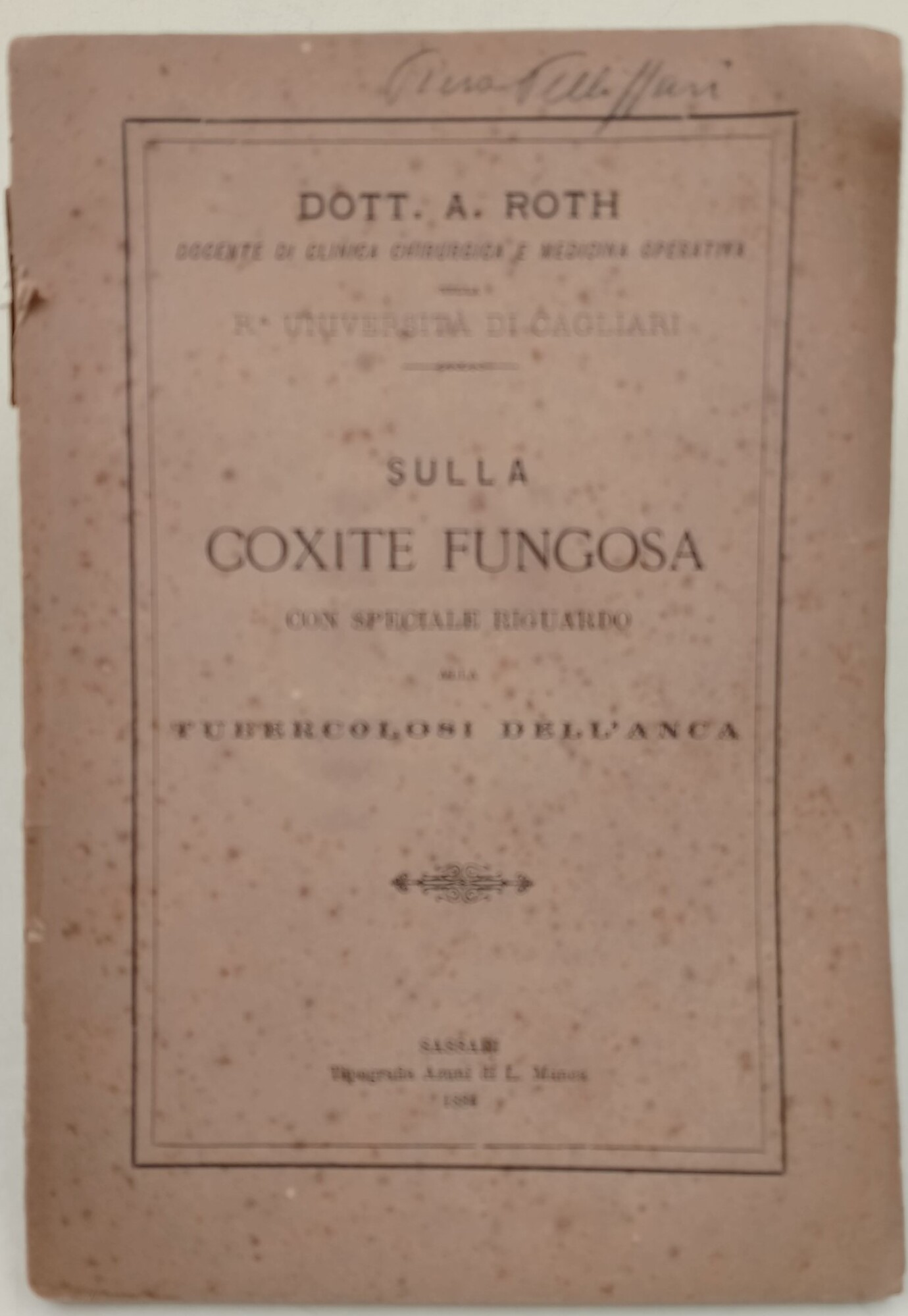 Sulla Coxite fungosa con speciale riguardo alla tubercolodi dell'anca