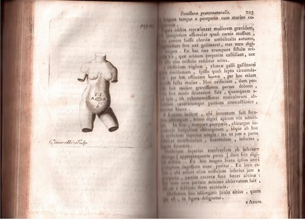 Liber de febribus et alia opuscula varia curante Georgio Christiano …