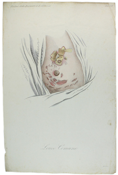 Tavola originale: LEUCE COMUNE., N. 38 (da: CLINICA DEL PARIGINO …