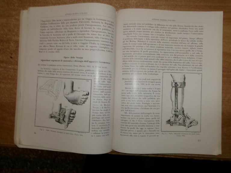 BIOGRAFIE DI CHIRURGHI del XVI e XIX Secolo... VITTORIO PUTTI …