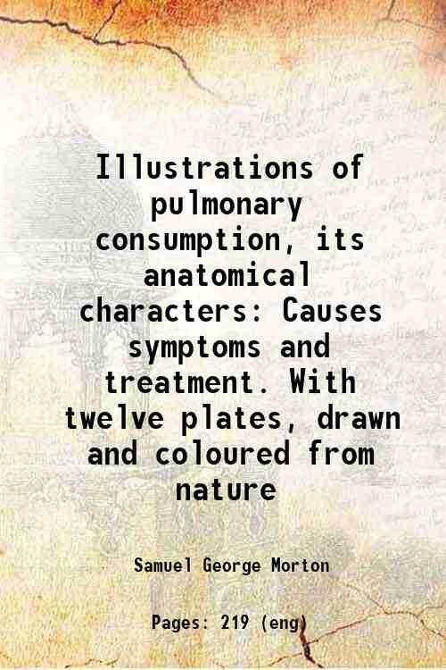 Illustrations of pulmonary consumption, its anatomical characters Causes symptoms and …
