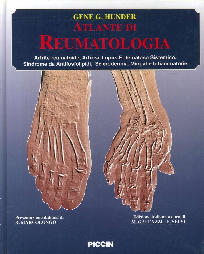 Atlante di Reumatologia. Artrite Reumatoide, Artrosi, Lupus Eritematoso Sistemico, Sindrome …