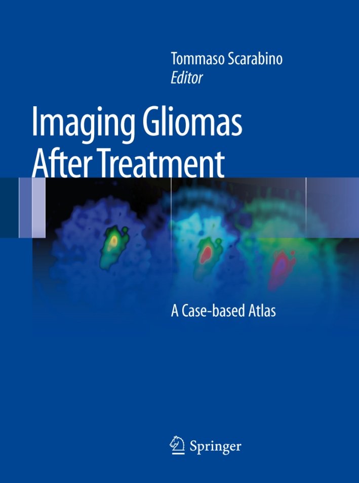 Imaging gliomas after treatment, Milano, Springer Italia, 2011 | Immagine principale