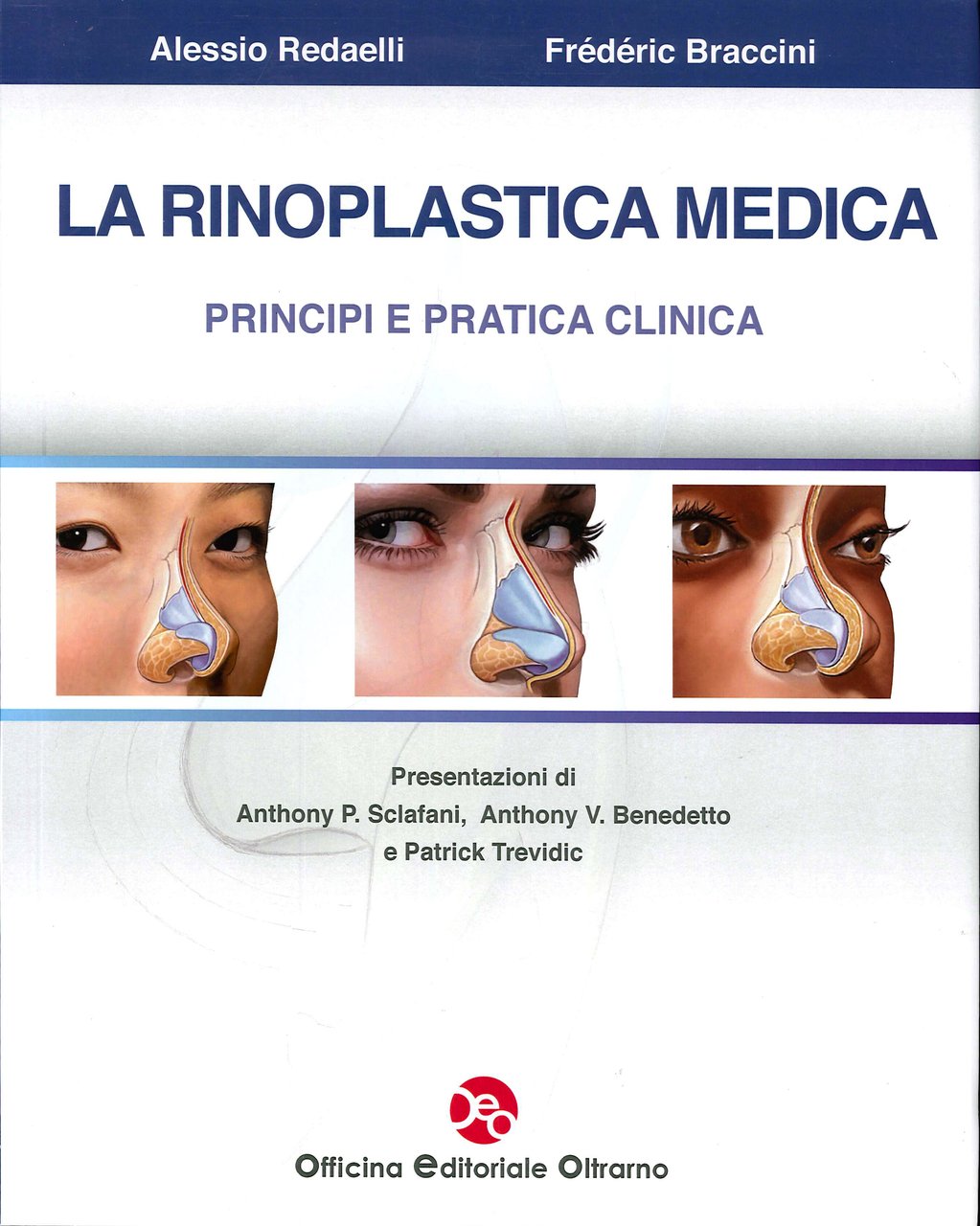 La rinoplastica medica. Principi e pratica clinica, Firenze, OEO Officina …