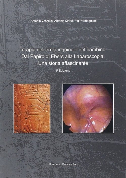 Terapia dell'ernia inguinale del bambino. Dal papiro di Ebers alla laparoscopia. Una storia affascinante, Reggio Calabria, Laruffa Editore, 2005