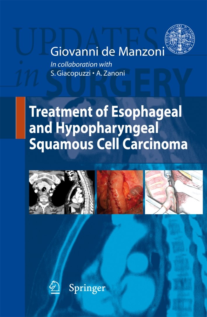 Treatment of esophageal and hypopharyngeal squamous cell carcinoma, Milano, Springer … | Immagine principale
