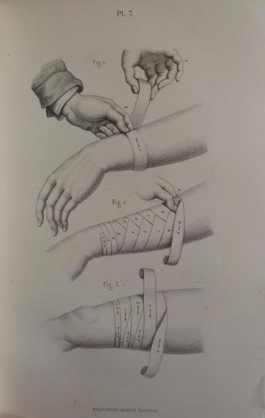 Précis iconographique de bandages, pansements et appareils.