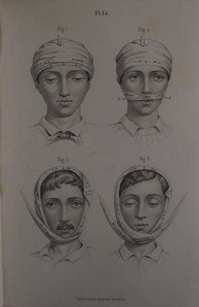 Précis iconographique de bandages, pansements et appareils.