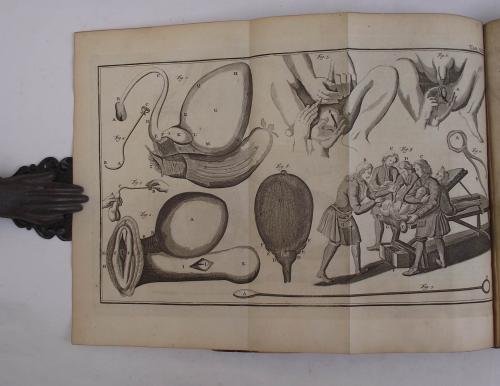 Institutiones chirurgicae in quibus quidquid ad rem chirurgicam pertinet, optima … | Immagine Gallery 3