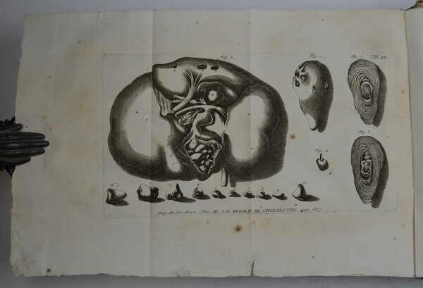 Disputationes ad morborum historiam ed curationem facientes…