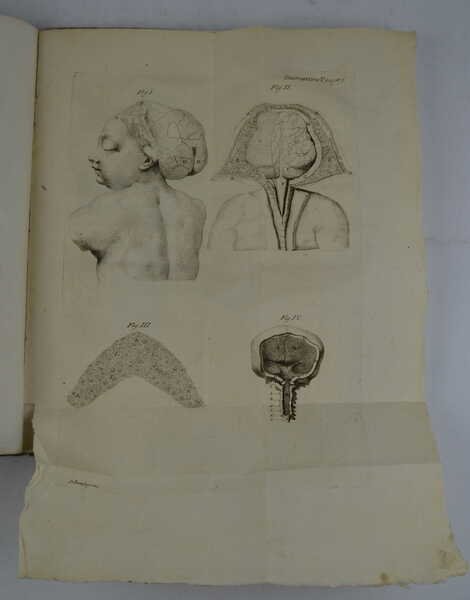 Saggio d'osservazioni, e memorie sopra alcuni casi singolari riscontrati nell'esercizio … | Immagine Gallery 3