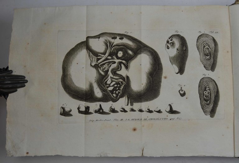 Disputationes ad morborum historiam ed curationem facientes…