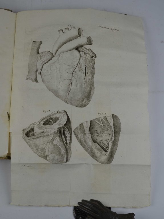 Saggio d'osservazioni, e memorie sopra alcuni casi singolari riscontrati nell'esercizio … | Immagine Gallery 2