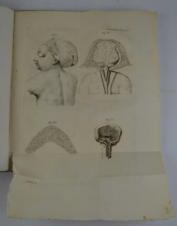 Saggio d'osservazioni, e memorie sopra alcuni casi singolari riscontrati nell'esercizio … | Immagine Gallery 4