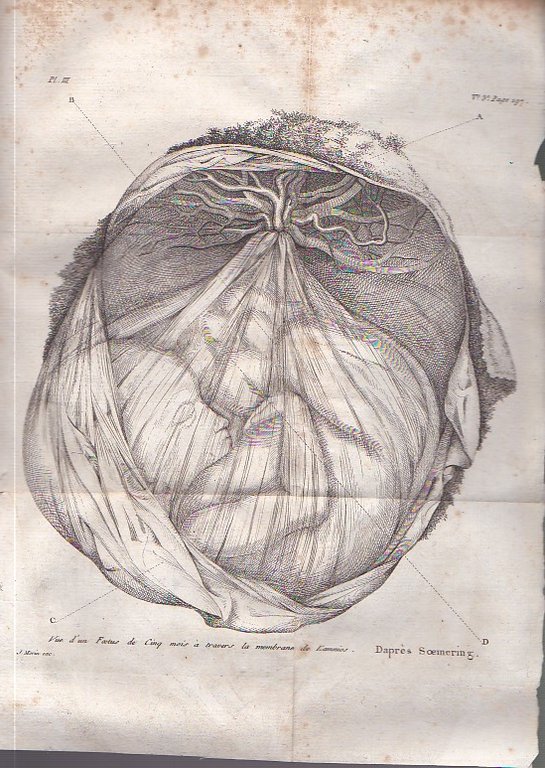 Histoire naturelle de la Femme, suivie d'un Traité d'Ygiène [sic] …