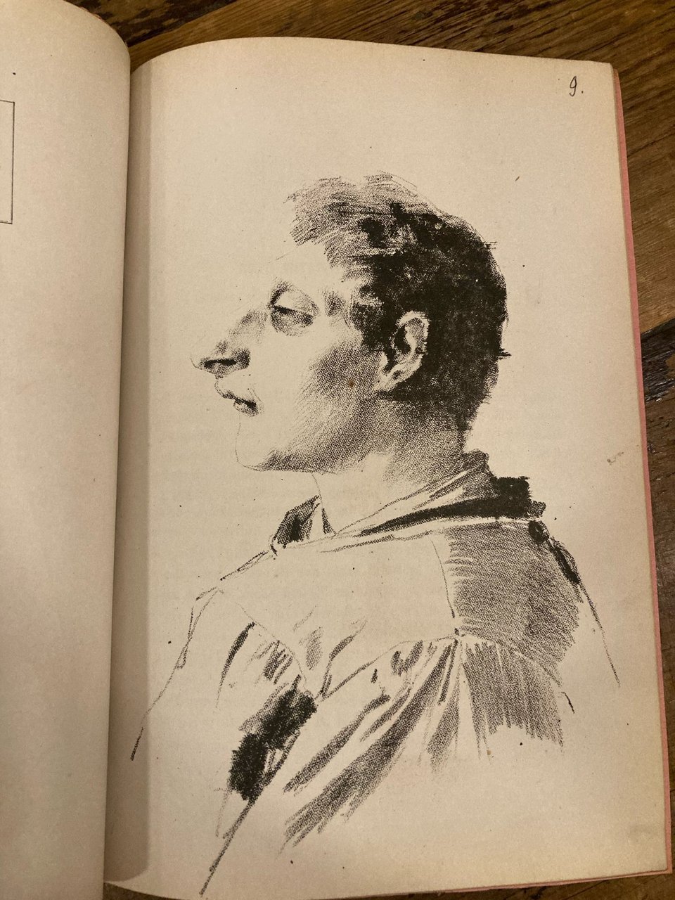 Note antropologiche e cliniche intorno all' idiota microcefalo B.[anone] Egidio …