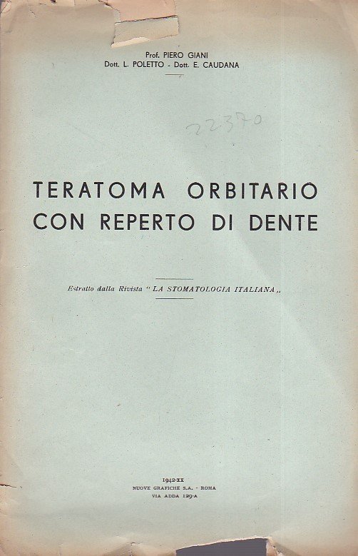 Teratoma orbitario con reperto di dente. Estratto dalla Rivista 'La …