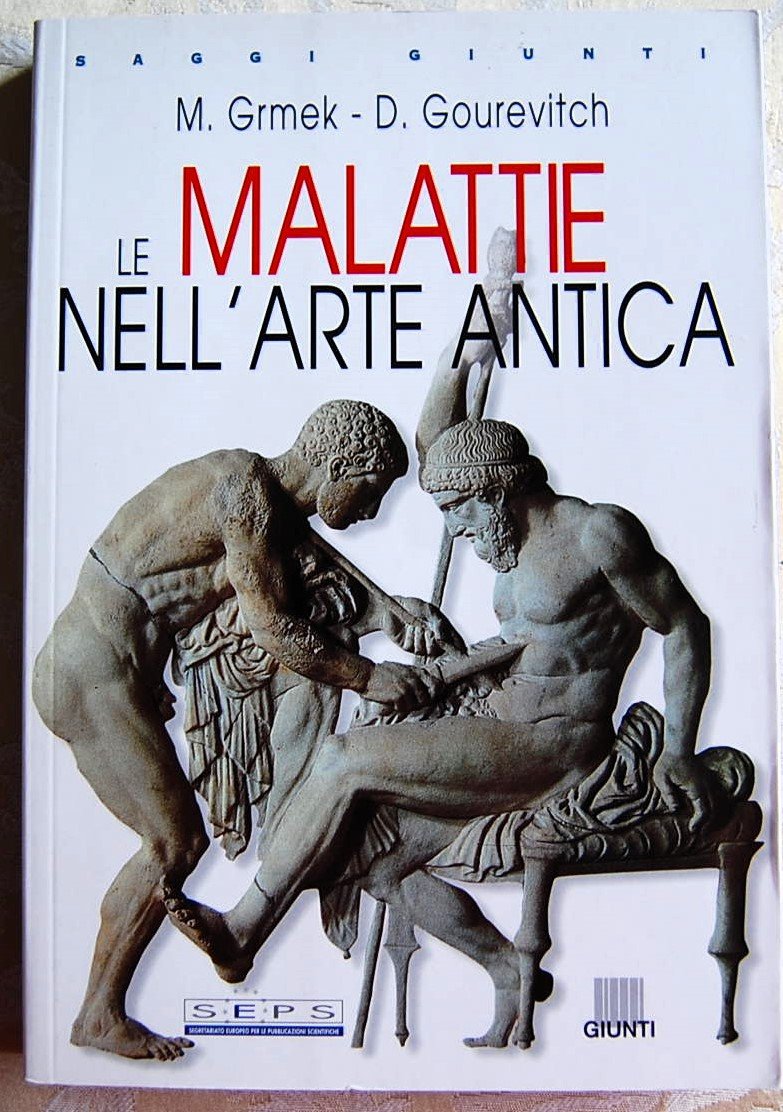 LE MALATTIE NELL'ARTE ANTICA.