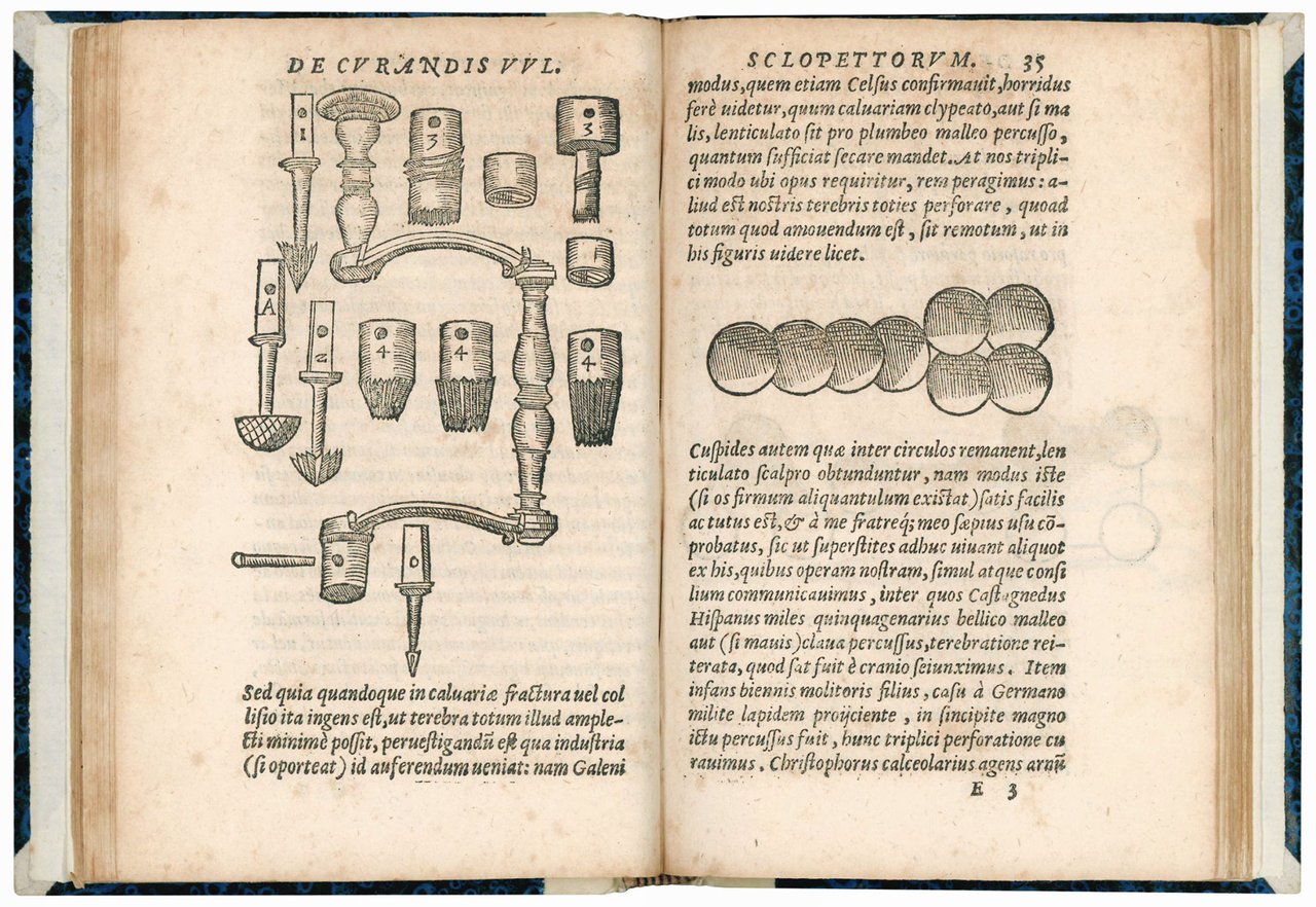 De curandis vulneribus sclopettorum, authore Leonardo Botallo Astense medico