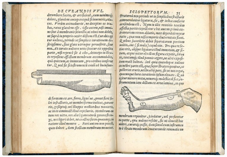 De curandis vulneribus sclopettorum, authore Leonardo Botallo Astense medico