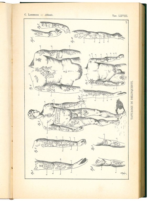 L'uomo delinquente in rapporto all'antropologia, alla giurisprudenza ed alla psichiatria. …