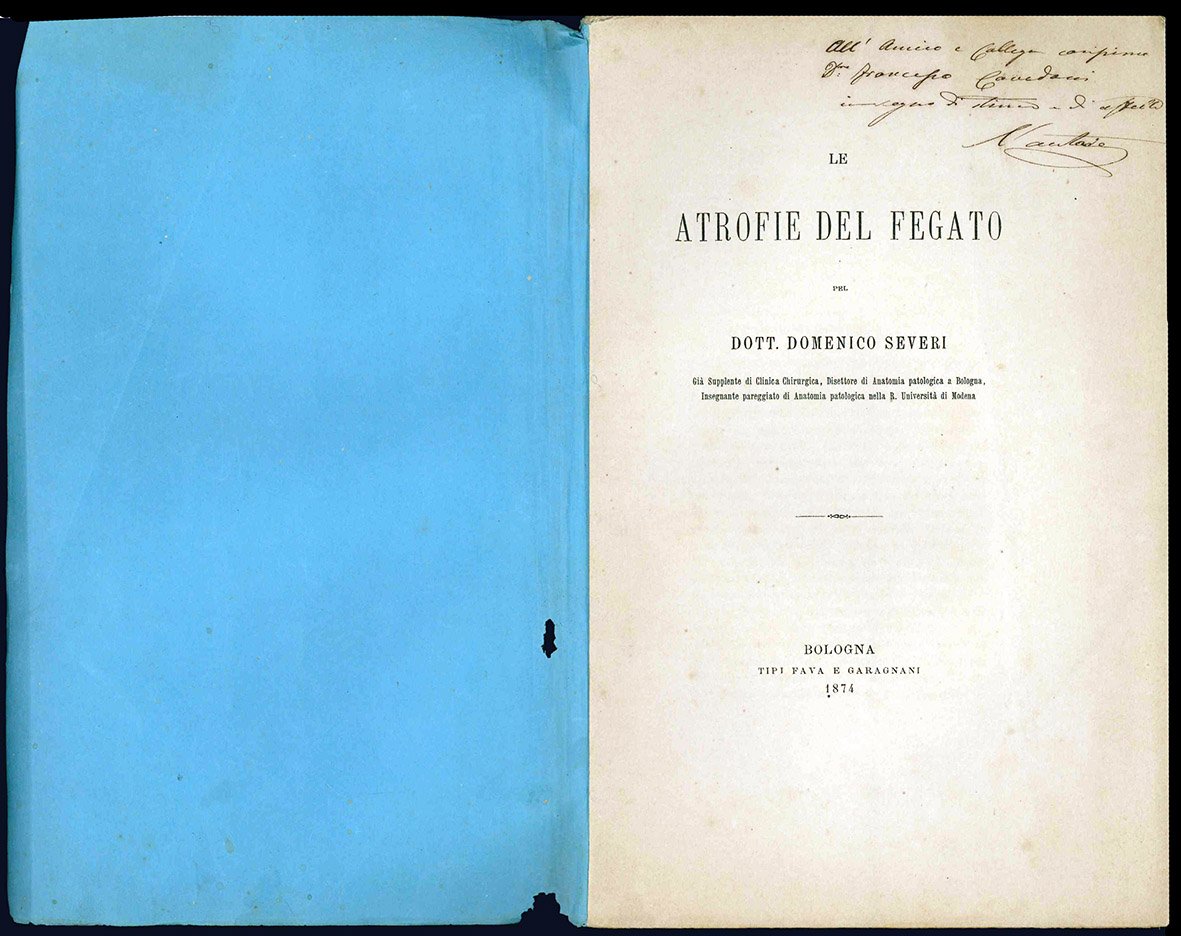 Le atrofie del fegato pel Dott. Domenico Severi. Già supplente …
