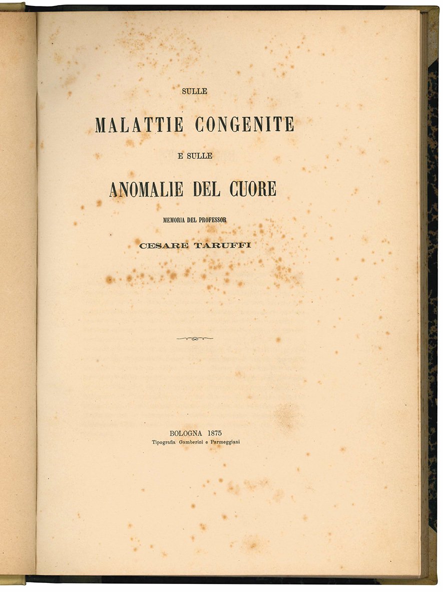 Sulle malattie congenite e sulle anomalie del cuore memoria del …