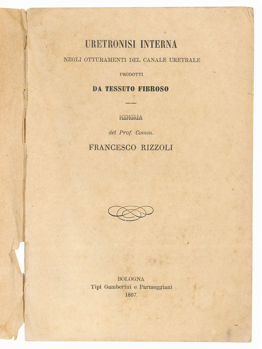 Uretronisi interna negli otturamenti del canale uretrale prodotti da tessuto …
