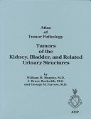 Atlas of Tumor Patology. Tumors of the Kidney and Bladder: … | Immagine principale