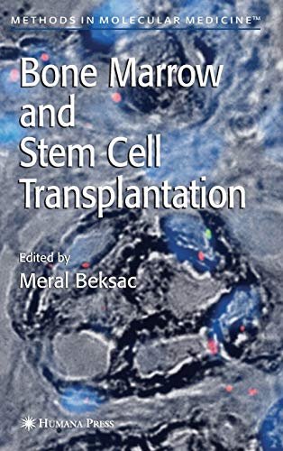 Bone Marrow and Stem Cell Transplantation: 134