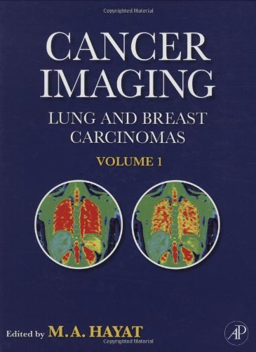 Cancer Imaging: Lung and Breast Carcinomas | Immagine principale