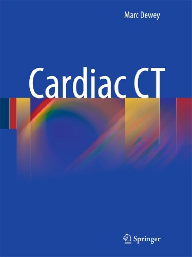 Cardiac Ct