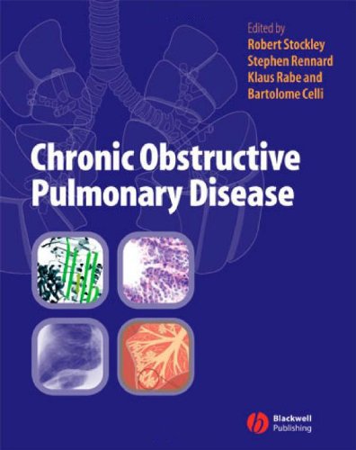 Chronic Obstructive Pulmonary Disease | Immagine principale