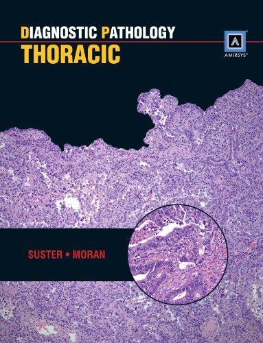 Diagnostic Pathology: Thoracic
