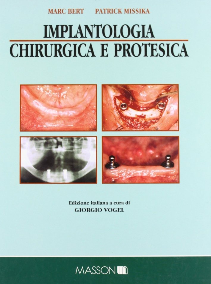Implantologia chirurgica e protesica