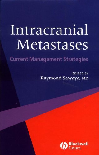 Intracranial Metastases: Current Management Strategies | Immagine principale