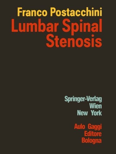 Lumbar Spinal Stenosis | Immagine principale