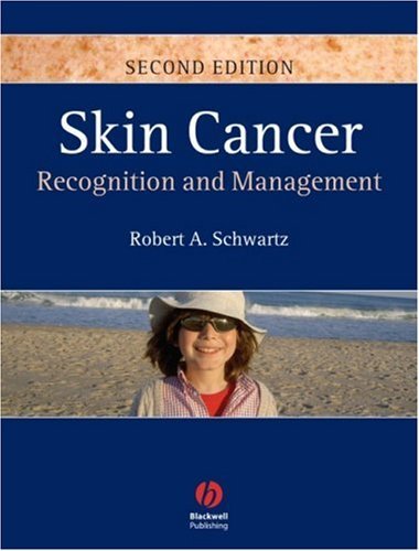 Skin Cancer: Recognition and Management | Immagine principale