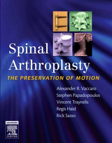 Spinal Arthroplasty: the Preservation of Motion