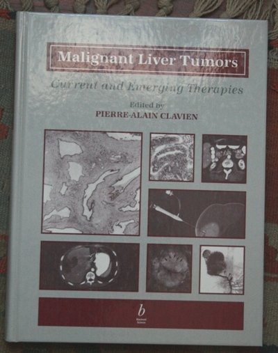 malignant liver tumors - current and emerging therapies