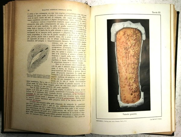 Trattato di patologia speciale medica e Terapia in 2 vol …