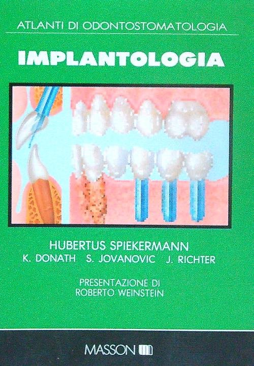 Implantologia | Immagine principale