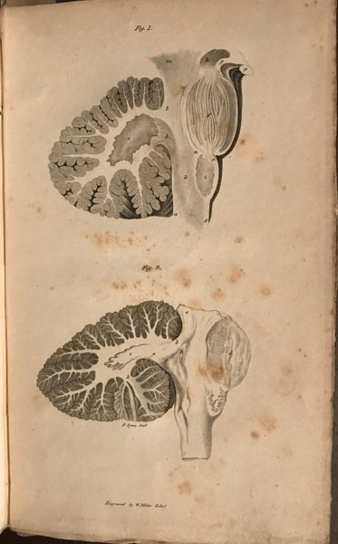 Observations on the structure of the brain. Comprising an estimate …