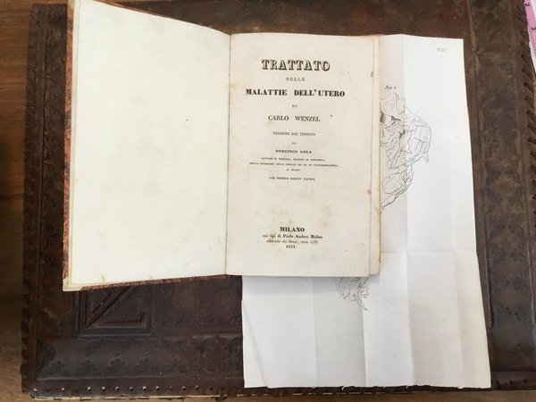 Trattato delle malattie dell’utero. Con 12 tavole