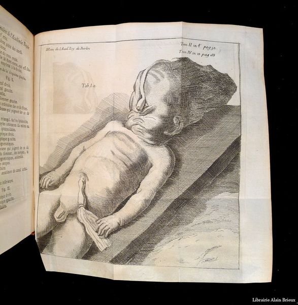 Mémoires de l'Académie royale de Prusse contenant l'anatomie, la physiologie, …